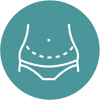 Abdominoplasty